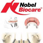 Giá Implant Nobel Biocare