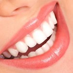 Tẩy trắng răng có hại gì không?