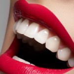 Tẩy trắng răng duy trì trong bao lâu