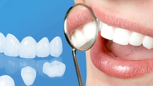 Biến chứng có thể xảy ra khi bọc răng sứ 1