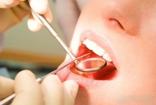 Ưu nhược điểm của hàm răng giả tháo lắp 1