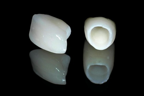 Ưu điểm của răng sứ Zirconia