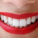 5 lợi ích khi tẩy trắng răng tự nhiên