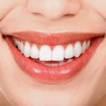 Cạo vôi răng có tác dụng gì - Nha khoa tư vấn