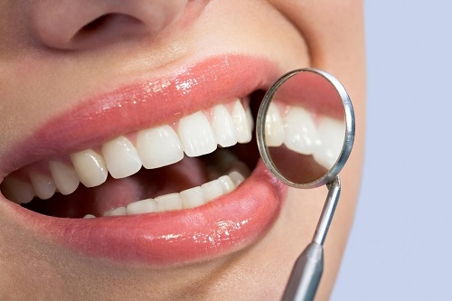 Bọc răng sứ có tác hại gì không? Những thông tin cần biết 4