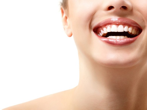 Tẩy trắng răng bị nhiễm tetracycline thực sự đem lại kết quả cao 3