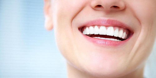 Bọc răng sứ không cần mài răng hiệu quả nhất tại nha khoa 4