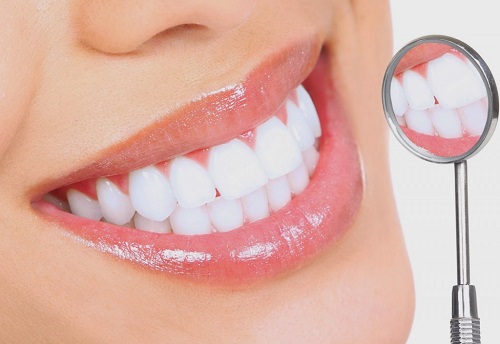 Răng bị ê buốt sau khi tẩy trắng - Hiện tượng này có bình thường không? 3
