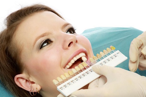 Tình trạng răng ổn định - Tẩy trắng răng mất bao lâu? 2
