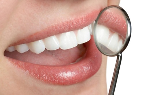 Kết quả bọc răng sứ giữ được bao lâu vậy? 1