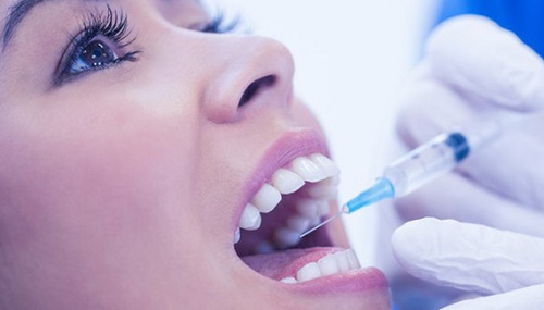 Nhổ răng hàm không đau có thật không? Nhờ nha khoa tư vấn 3