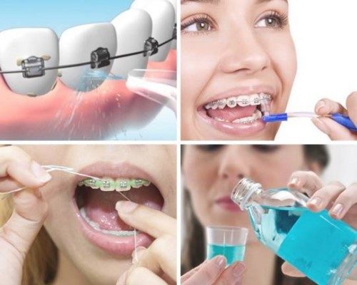 Một số đặc điểm khi chọn bàn chải đánh răng *